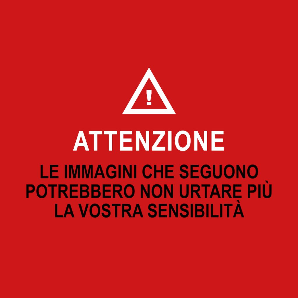 ATTENZIONE